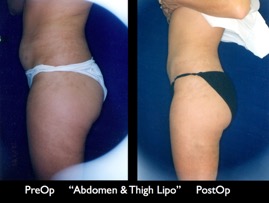 Cosmetic Patients.064.jpg
