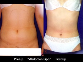 Cosmetic Patients.065.jpg
