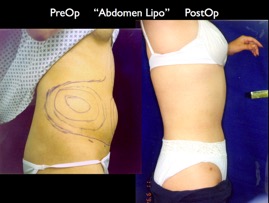 Cosmetic Patients.066.jpg