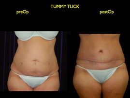 inner thigh.010.jpg