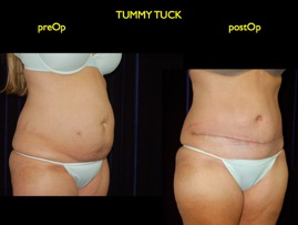 inner thigh.011.jpg