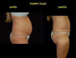 inner thigh.012.jpg