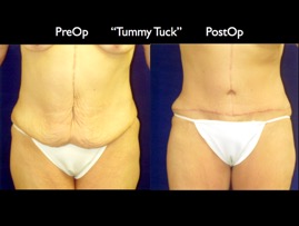 Tum2.001.jpg