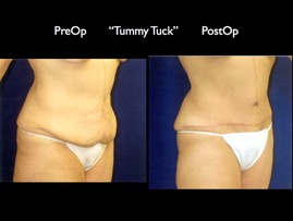 Tum2.003.jpg