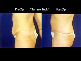 Tum2.004.jpg