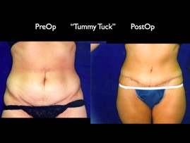 Tum2.008.jpg