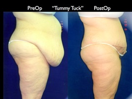Tum2.022.jpg