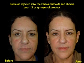 Radiess2-8.008.jpg