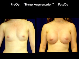 Breast-Aug.013.jpg