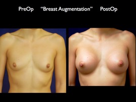 Breast-Aug.019.jpg