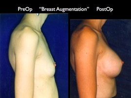 Breast-Aug2.045.jpg