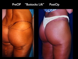 ButLiftold.001.jpg