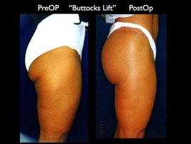 ButLiftold.003.jpg