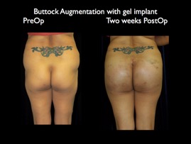 Butt-Aug.004.jpg