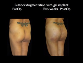 Butt-Aug.005.jpg