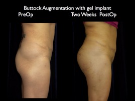 Butt-Aug.007.jpg
