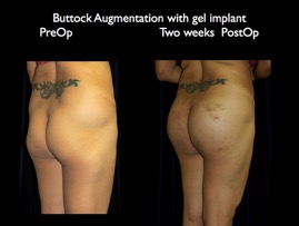 Butt-Aug.006.006.jpg