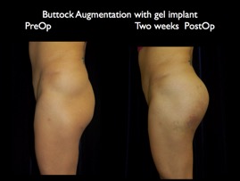 Butt-Aug.008.008.jpg