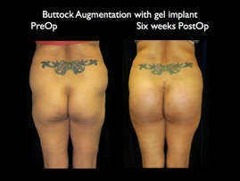 Butt6wkspo.009.jpg