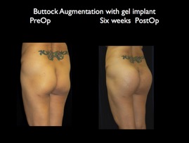 Butt6wkspo.010.jpg