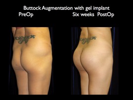 Butt6wkspo.011.jpg