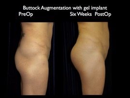 Butt6wkspo.012.jpg