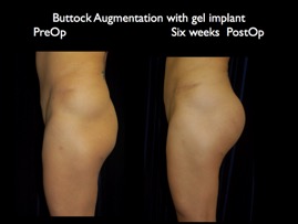 Butt6wkspo.013.jpg