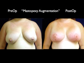 Cosmetic Patients.078.jpg