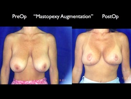 Cosmetic Patients.081.jpg