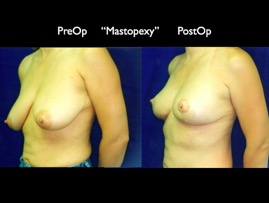 Cosmetic Patients.083.jpg