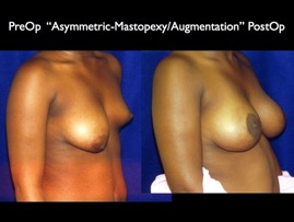 Cosmetic Patients.086.jpg
