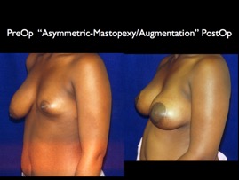 Cosmetic Patients.087.jpg