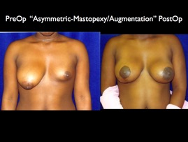 Cosmetic Patients.088.jpg