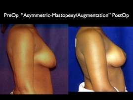 Cosmetic Patients.089.jpg