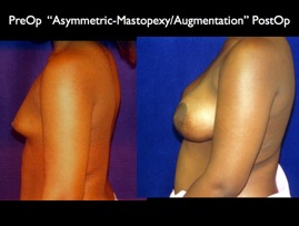 Cosmetic Patients.090.jpg