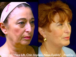 FacLift.018.jpg