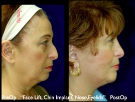 FacLift.019.jpg