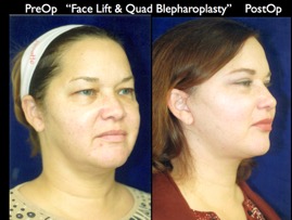 Cosmetic Patients.013.jpg
