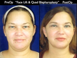 Cosmetic Patients.014.jpg