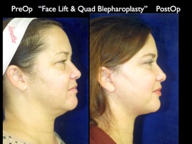 Cosmetic Patients.015.jpg