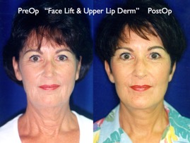 Cosmetic Patients.027.jpg
