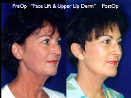 Cosmetic Patients.026.jpg