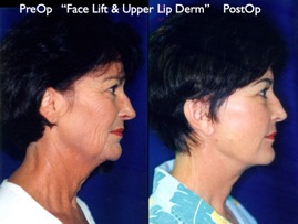 Cosmetic Patients.028.jpg