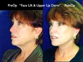 Cosmetic Patients.032.jpg