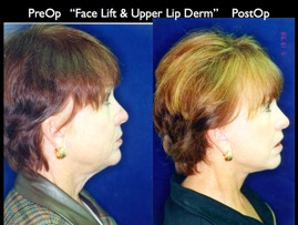 Cosmetic Patients.034.jpg