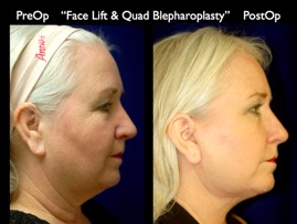 FacLift.013.jpg