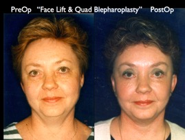 Cosmetic Patients.017.jpg