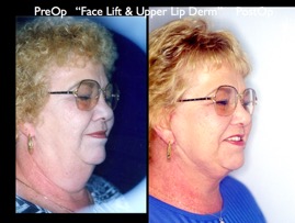 Cosmetic Patients.024.jpg