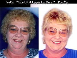 Cosmetic Patients.025.jpg