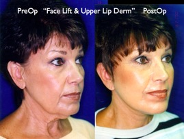 Cosmetic Patients.035.jpg